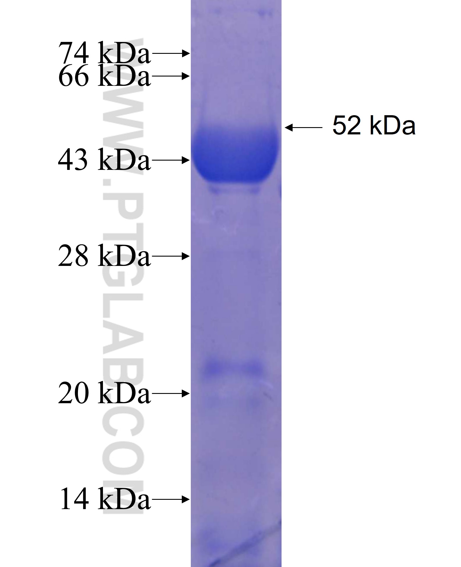 CTNNA1 fusion protein Ag23603 SDS-PAGE