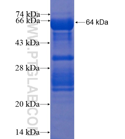 CTNNA1 fusion protein Ag3565 SDS-PAGE