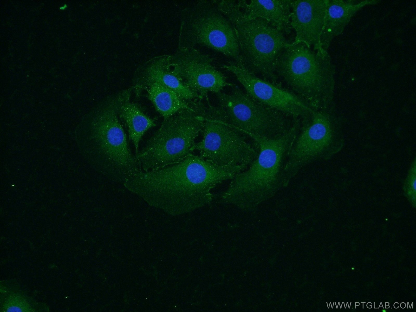 IF Staining of SH-SY5Y using 14362-1-AP