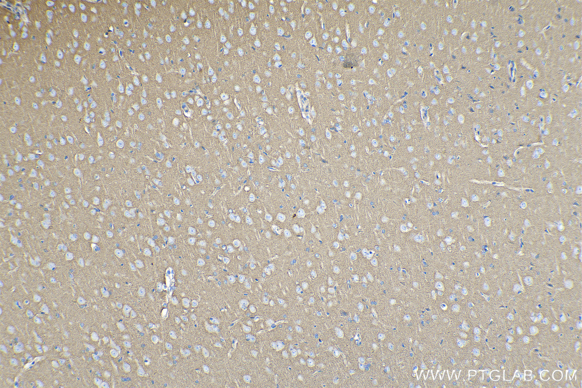 IHC staining of rat brain using 14362-1-AP