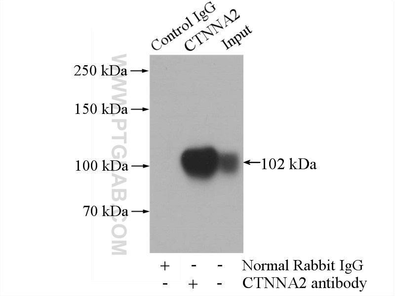 IP experiment of SH-SY5Y using 14362-1-AP