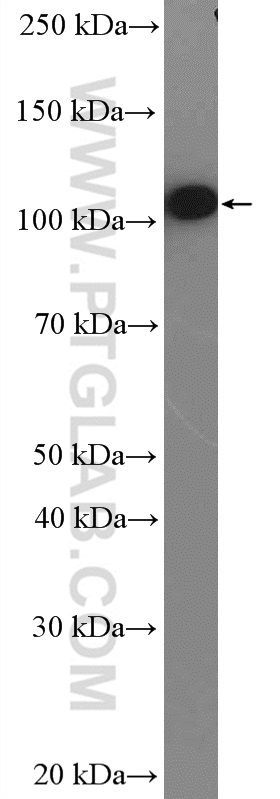 WB analysis of SH-SY5Y using 14362-1-AP