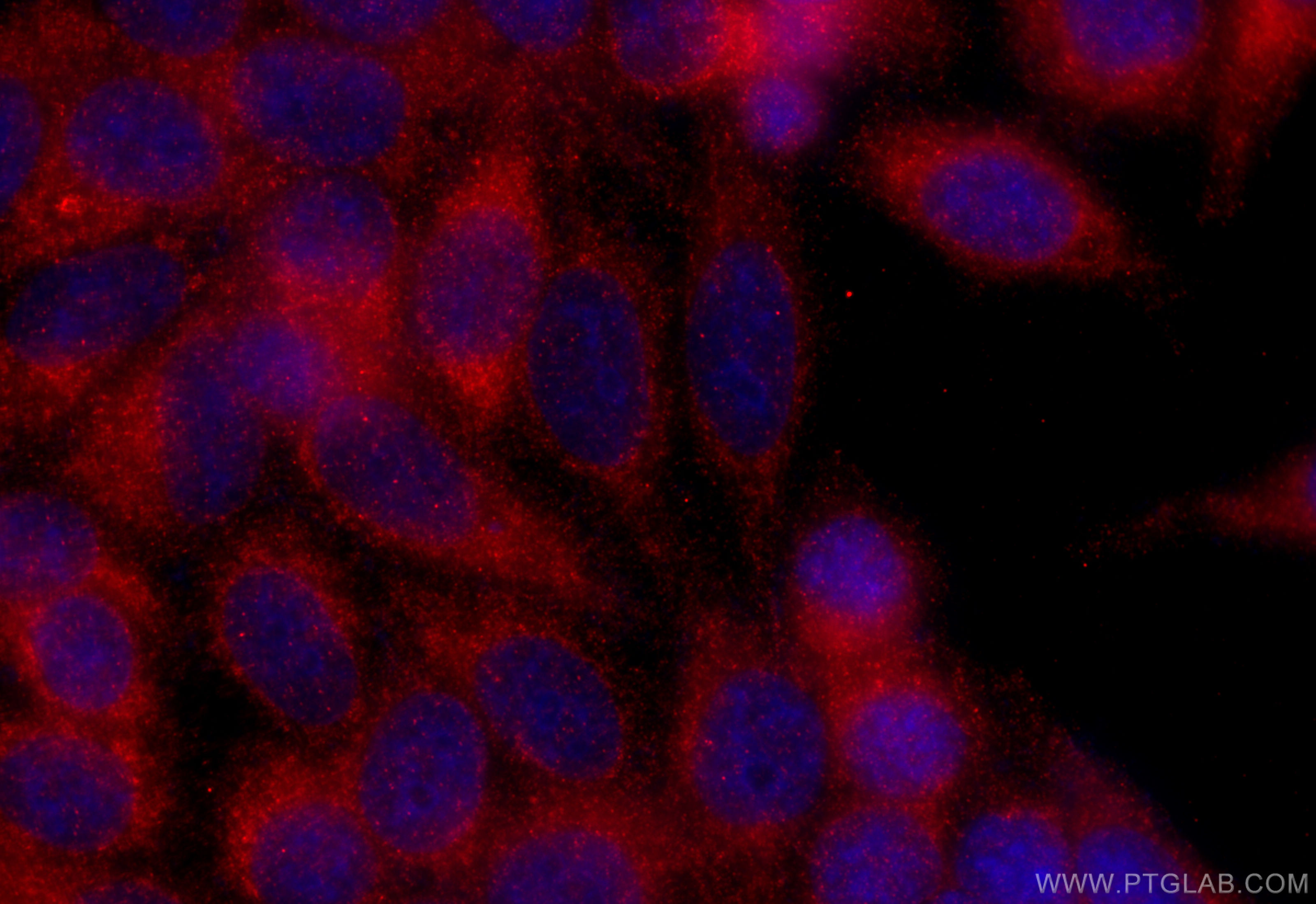 IF Staining of HepG2 using 13974-1-AP