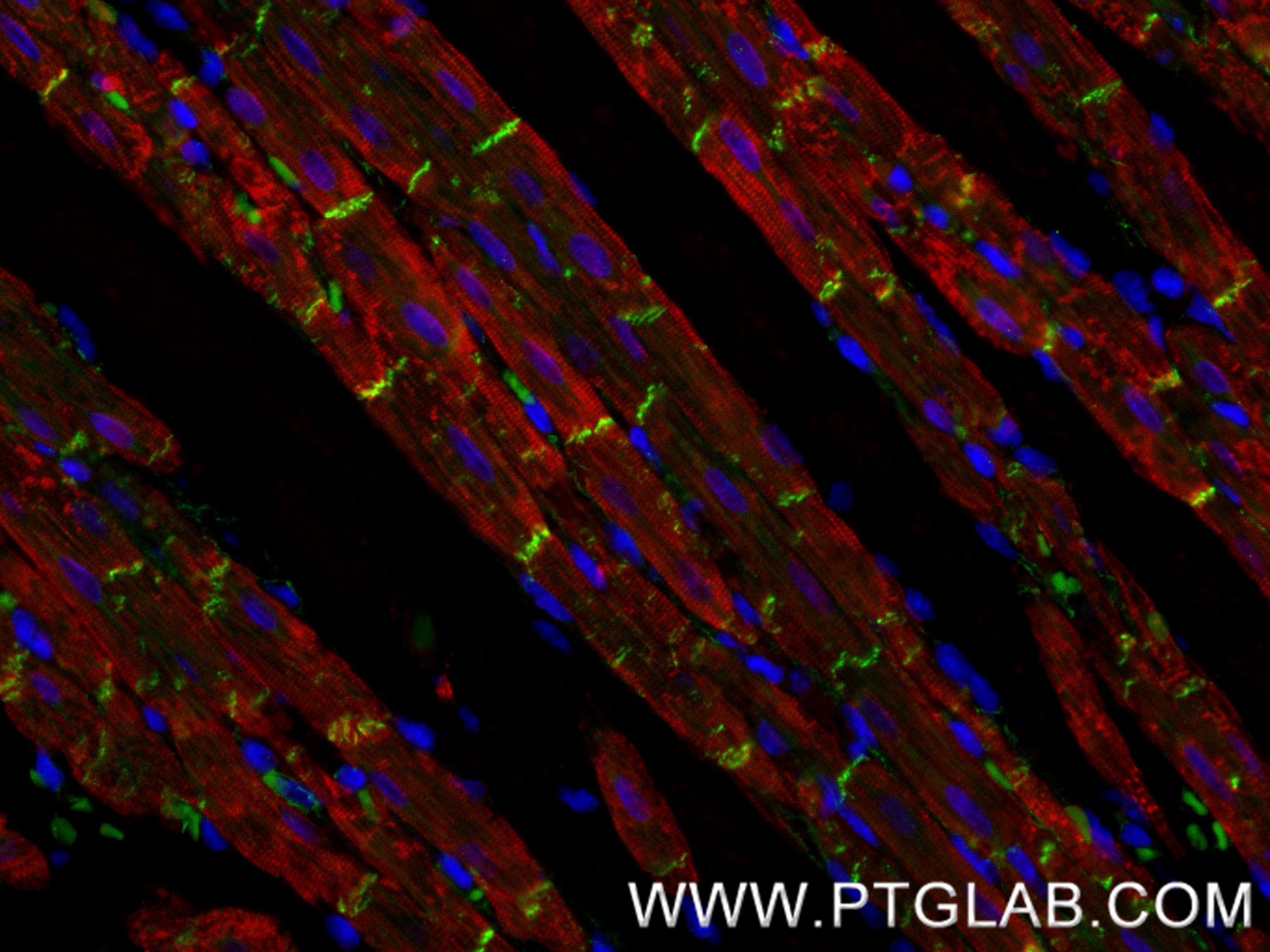 IF Staining of rat heart using 87022-1-RR