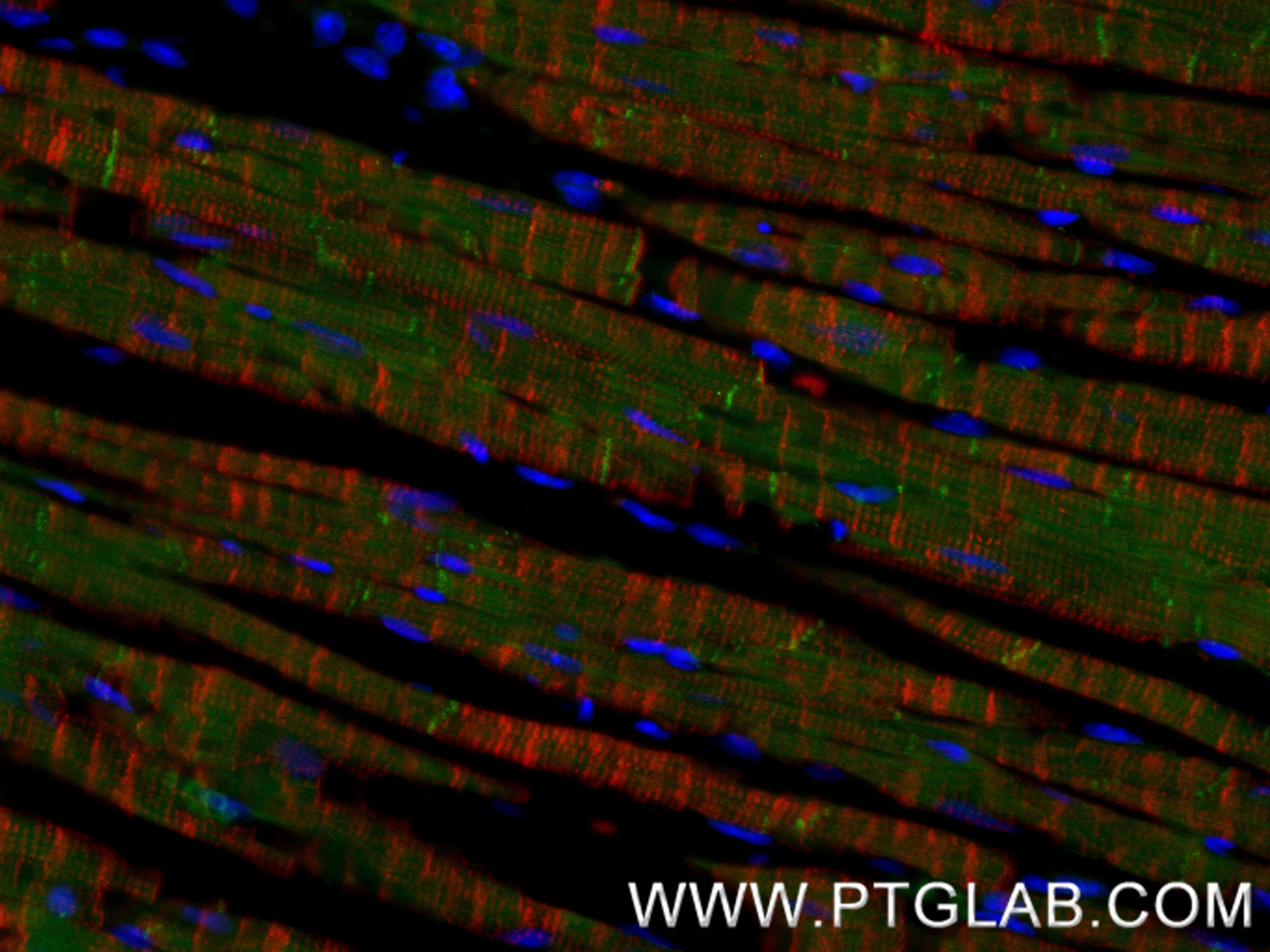 IF Staining of mouse heart using 87022-1-RR