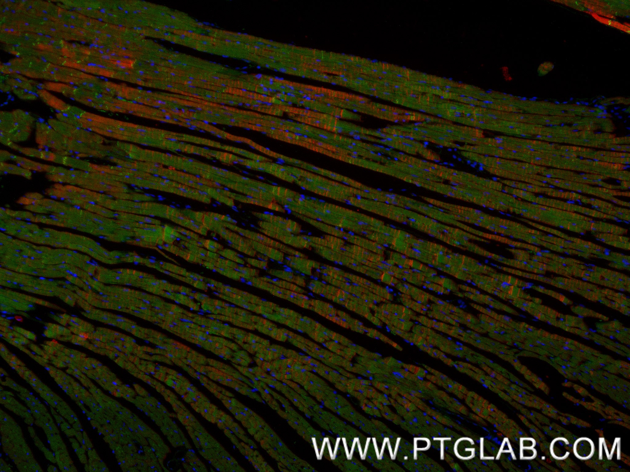 IF Staining of mouse heart using 87022-1-RR