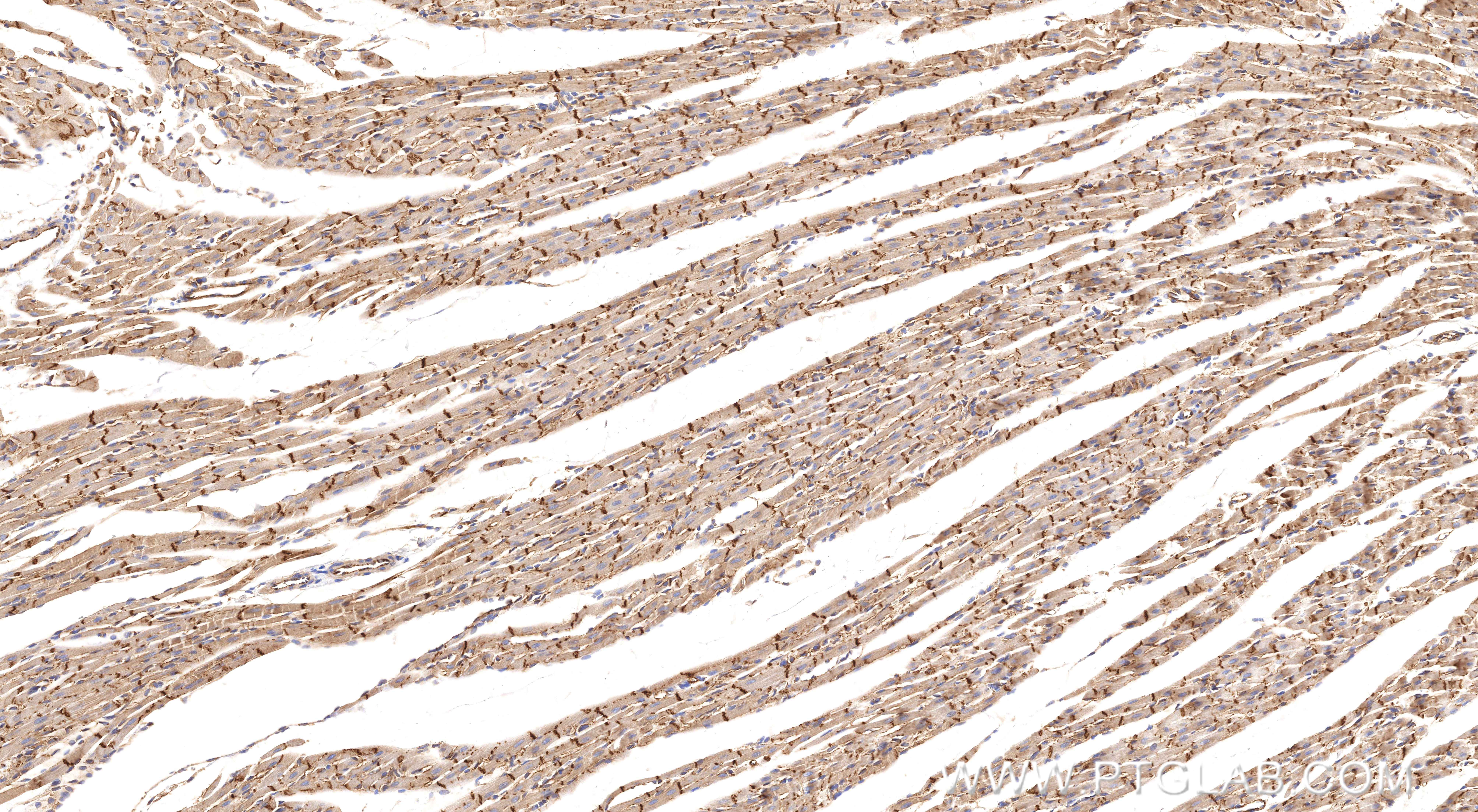 IHC staining of rat heart using 87022-1-RR