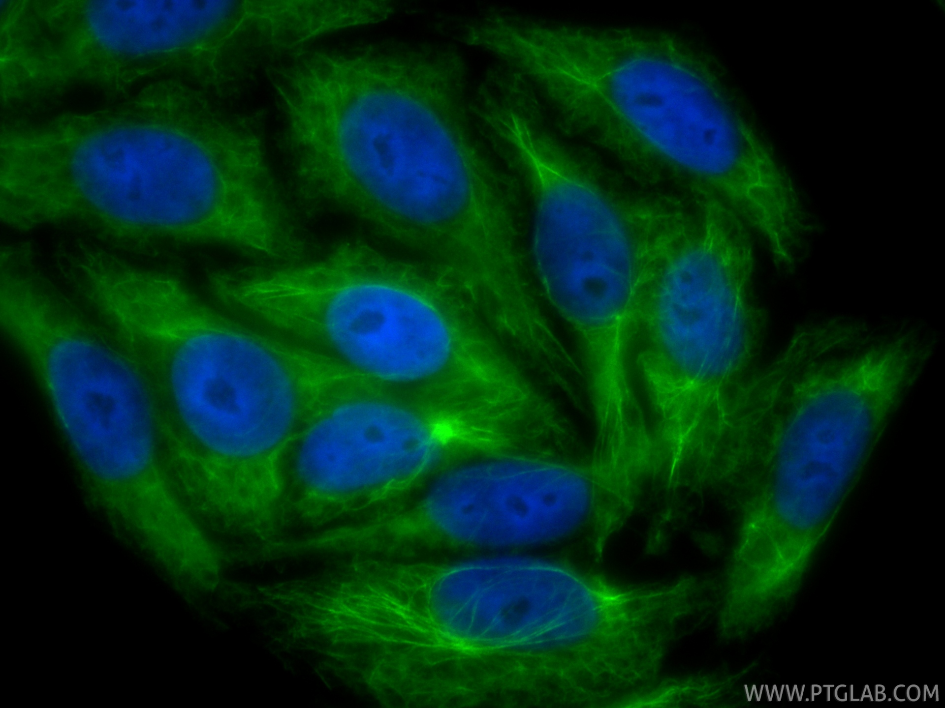 IF Staining of HepG2 using CL488-87022 IF Staining of HepG2 using CL488-87022