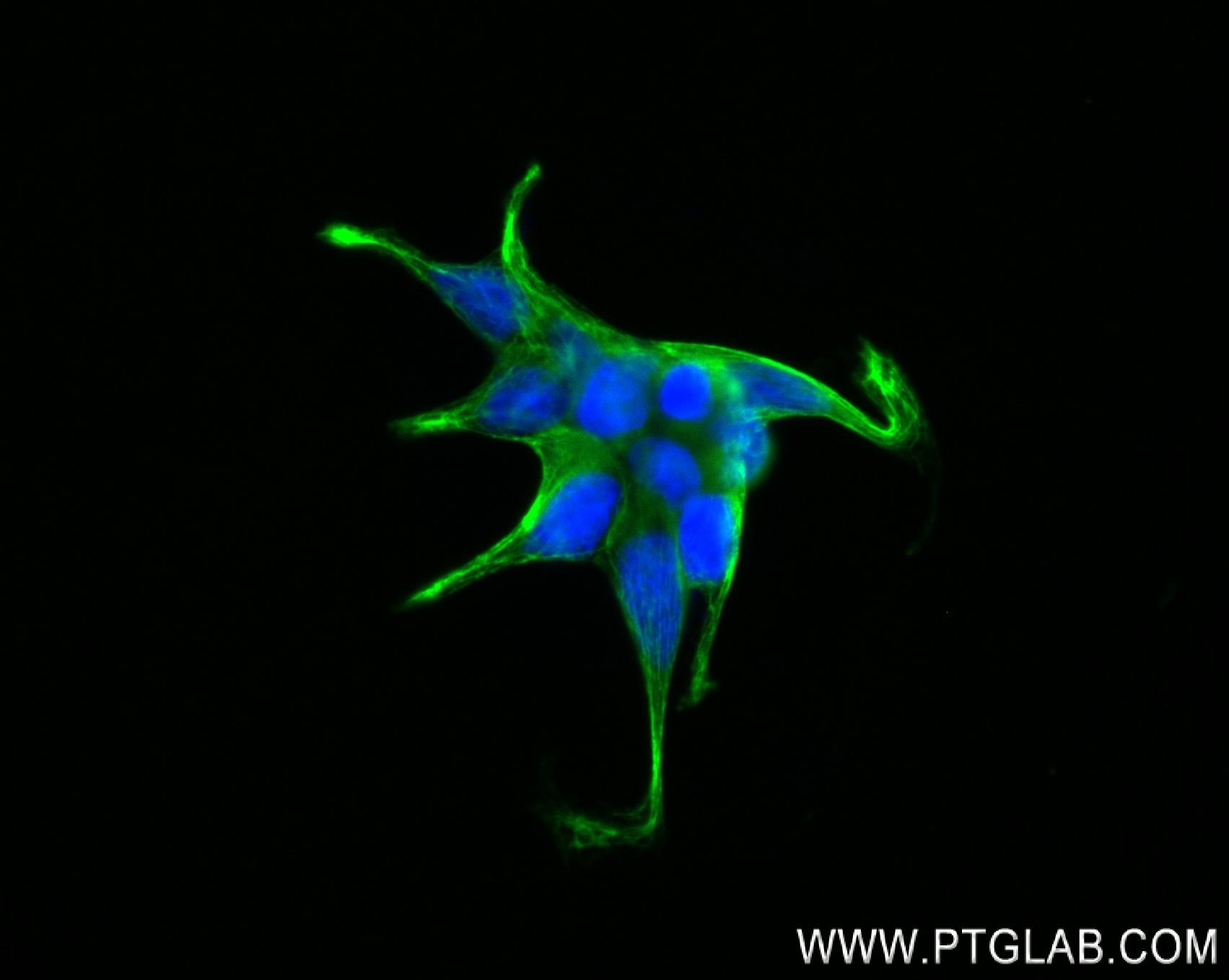IF Staining of LNCaP using 84052-1-RR (same clone as 84052-1-PBS)