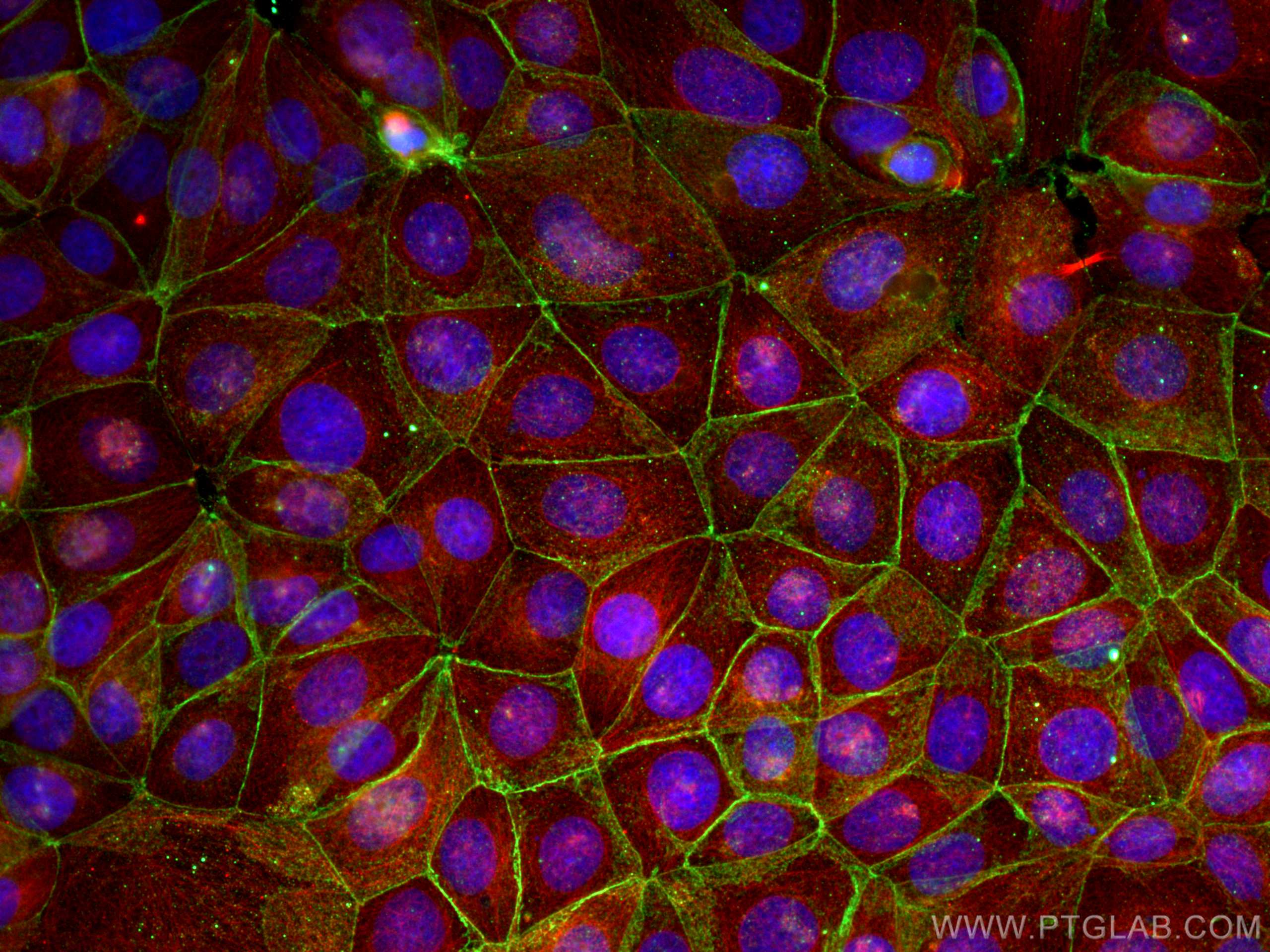 IF Staining of MCF-7 using 66379-1-Ig