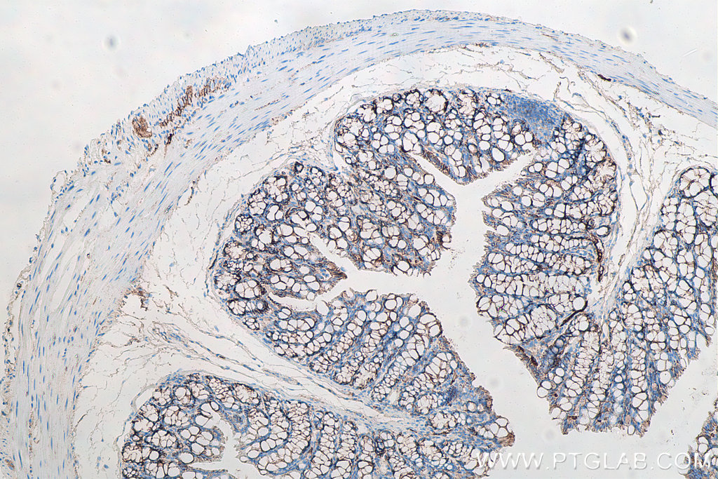 IHC staining of mouse colon using 66379-1-Ig IHC staining of mouse colon using 66379-1-Ig