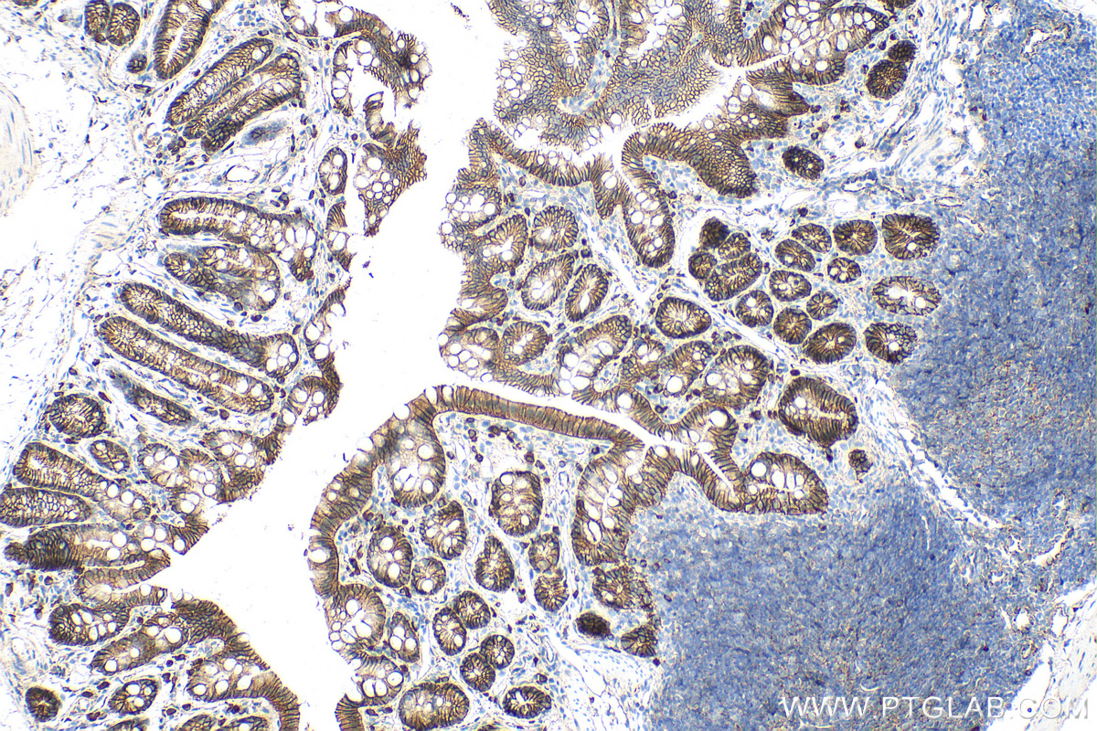 IHC staining of mouse colon using 66379-1-Ig (same clone as 66379-1-PBS)