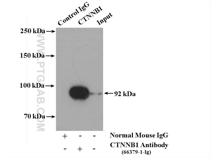 IP experiment of mouse brain using 66379-1-Ig (same clone as 66379-1-PBS)