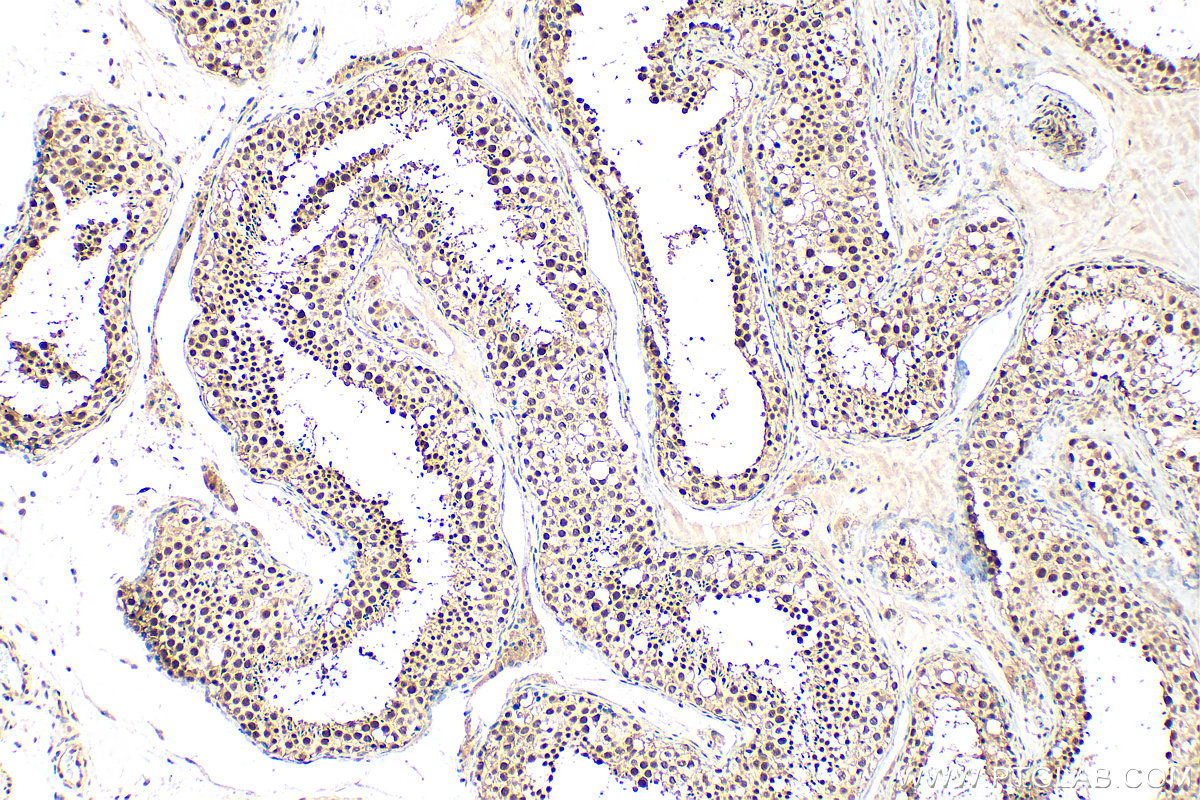 IHC staining of human testis using 13665-1-AP