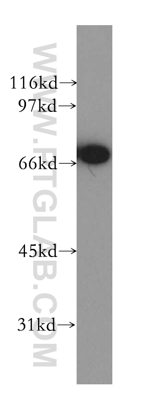 WB analysis of Jurkat using 13665-1-AP