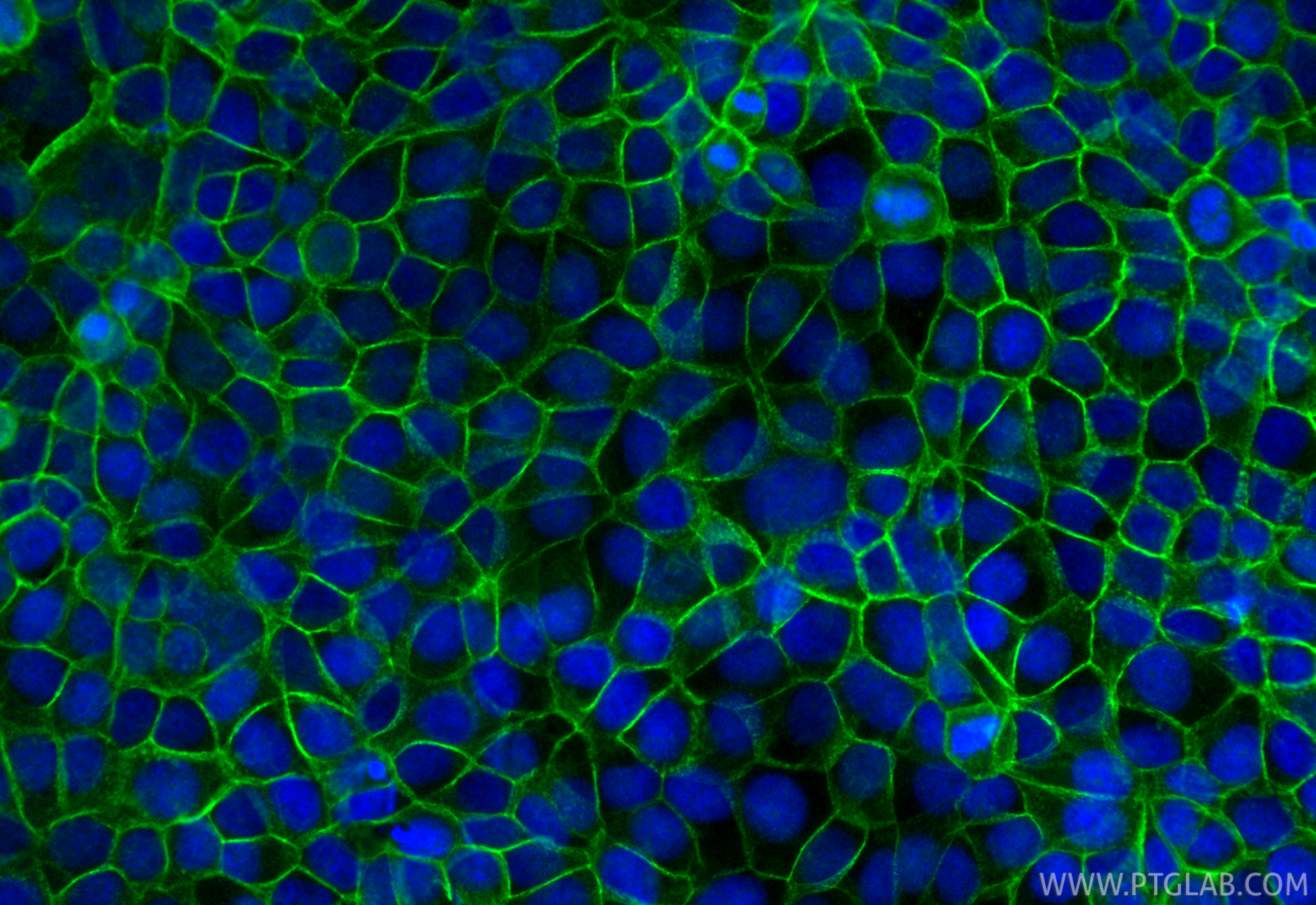 IF Staining of MCF-7 using 12180-1-AP
