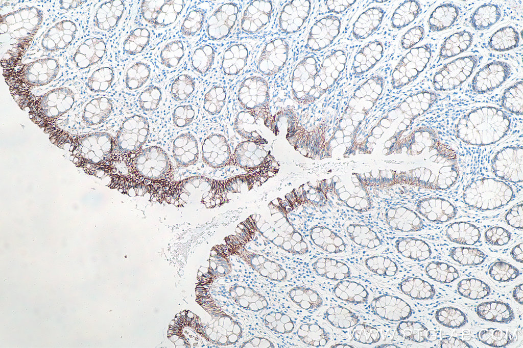 IHC staining of human colon using 66208-1-Ig IHC staining of human colon using 66208-1-Ig