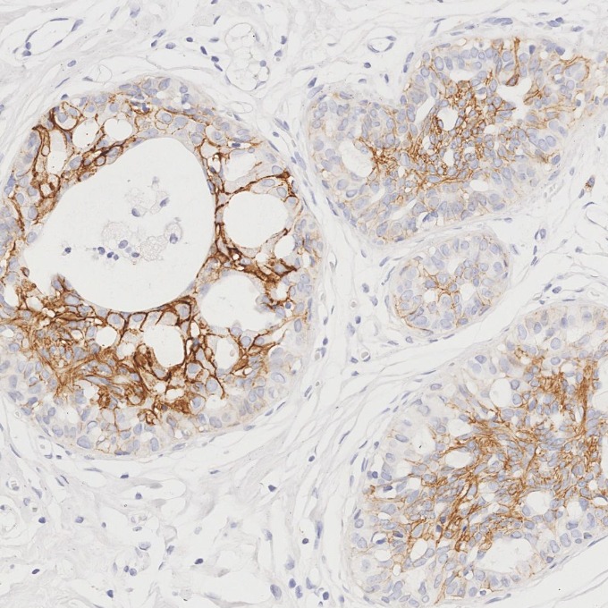 IHC staining of human breast using 66208-1-Ig IHC staining of human breast using 66208-1-Ig