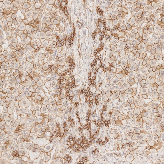 IHC staining of human liver using 66208-1-Ig IHC staining of human liver using 66208-1-Ig