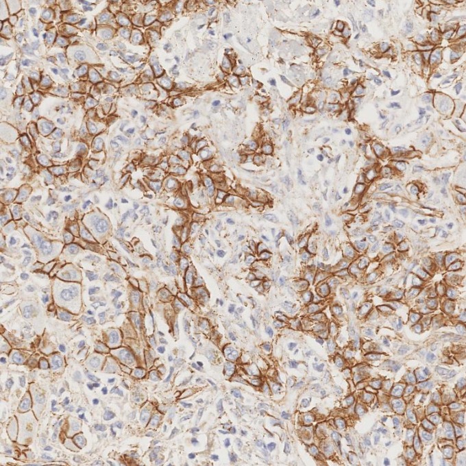IHC staining of human liver using 66208-1-Ig IHC staining of human liver using 66208-1-Ig