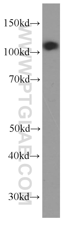 p120 Catenin Monoclonal antibody