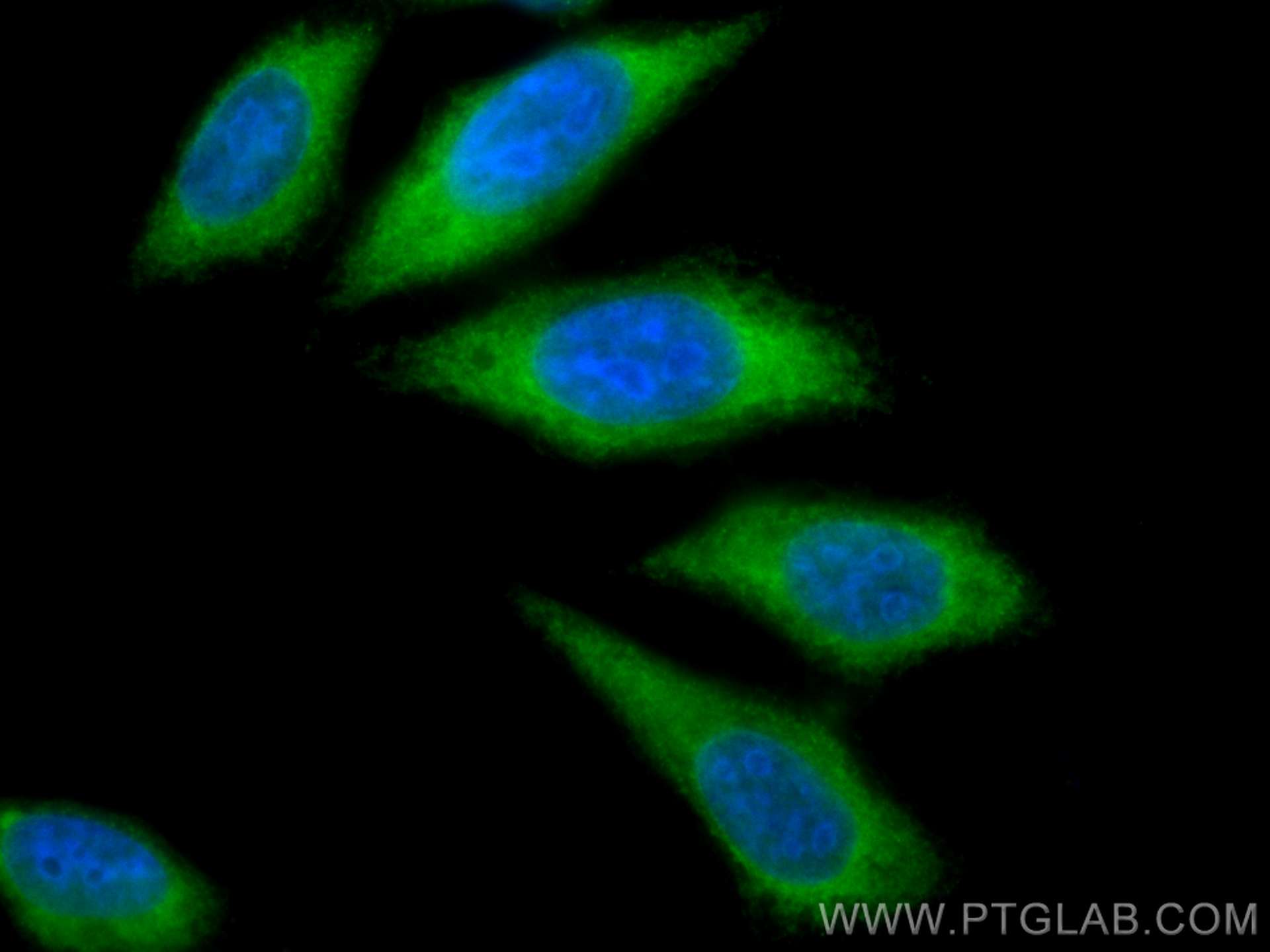 CTP synthase