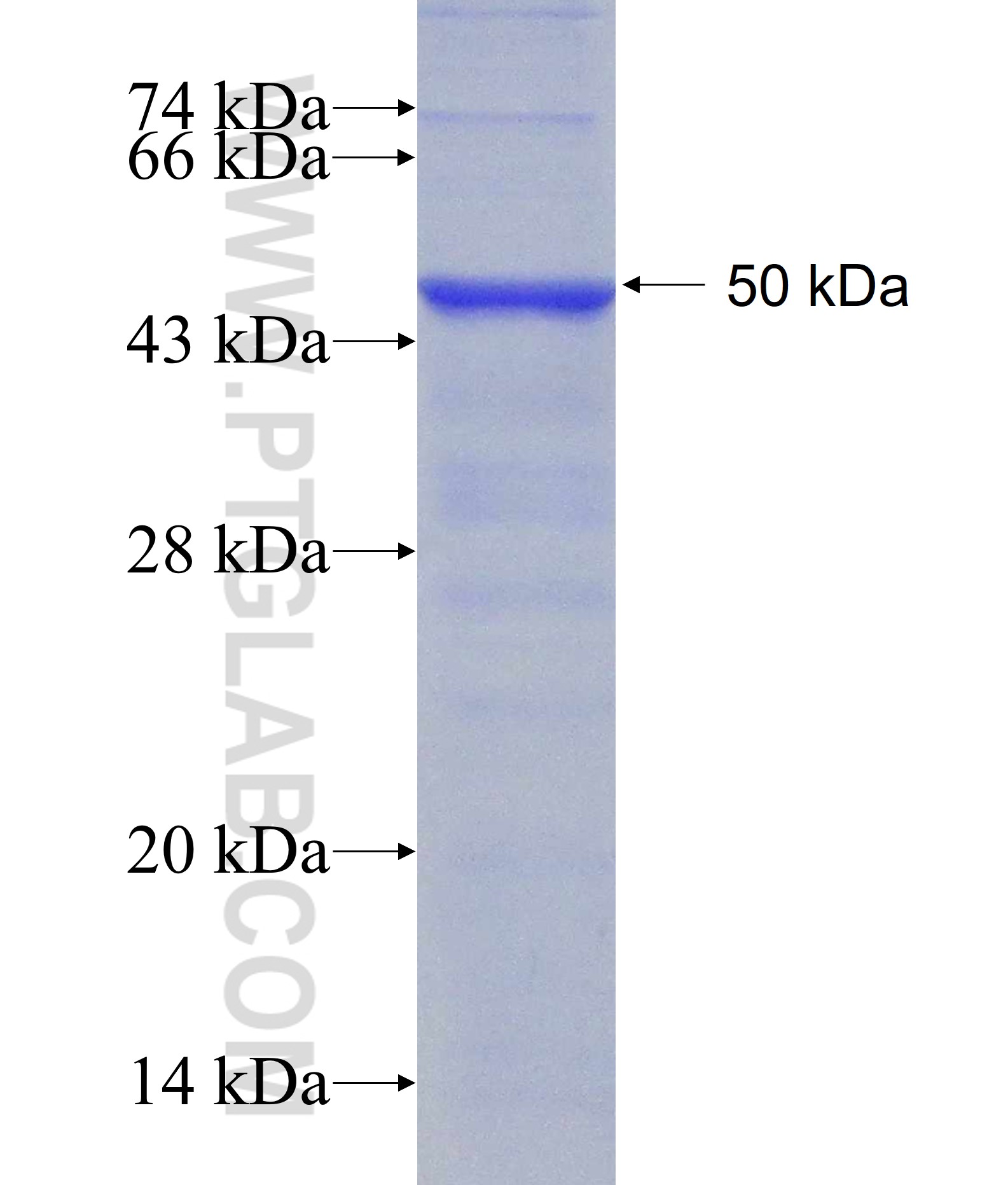 CTPS fusion protein Ag8928 SDS-PAGE