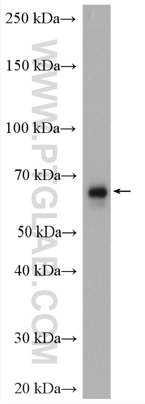 WB analysis of mouse testis using 12852-1-AP