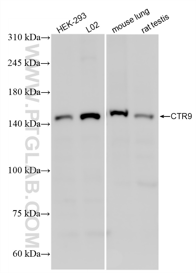 WB analysis using 85432-4-RR (same clone as 85432-4-PBS)