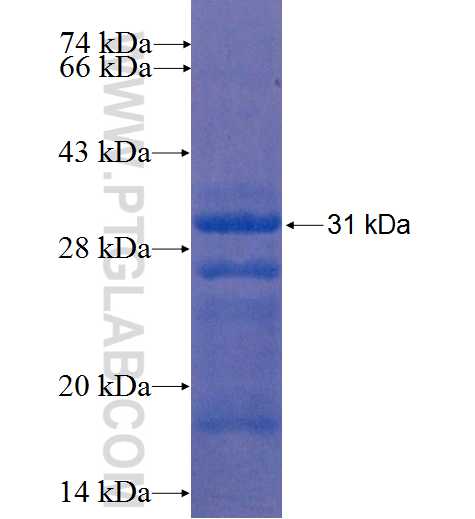 CTRB1 fusion protein Ag8820 SDS-PAGE CTRB1 fusion protein Ag8820 SDS-PAGE