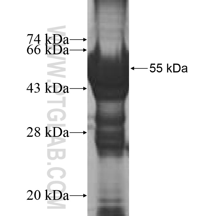 CTRC fusion protein Ag9572 SDS-PAGE
