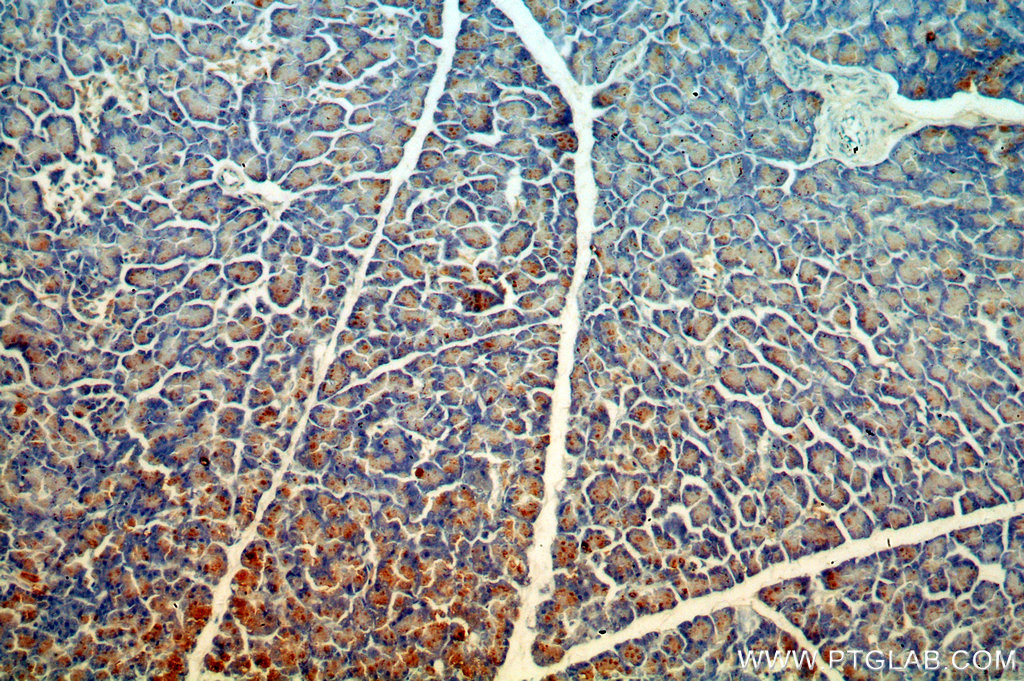 IHC staining of human pancreas using 14856-1-AP