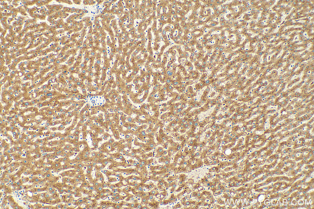 IHC staining of human liver using 15020-1-AP