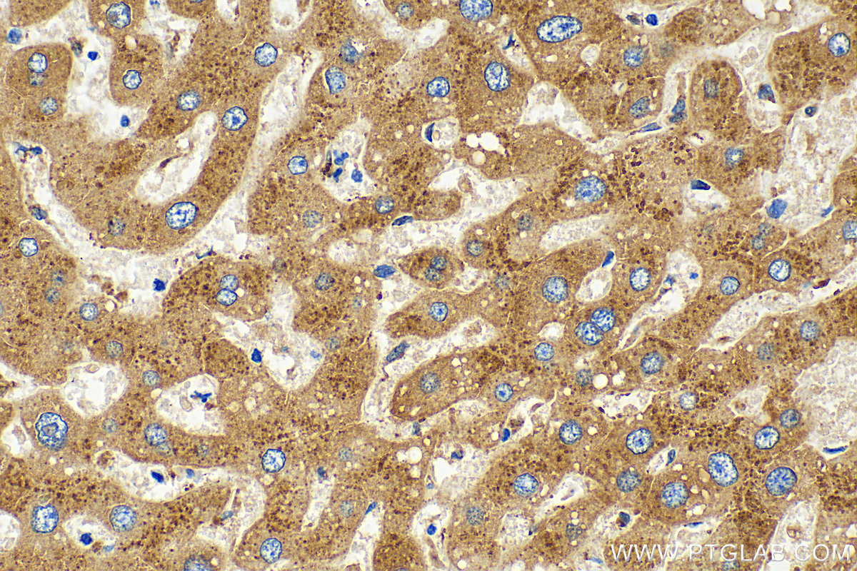 IHC staining of human liver using 15020-1-AP