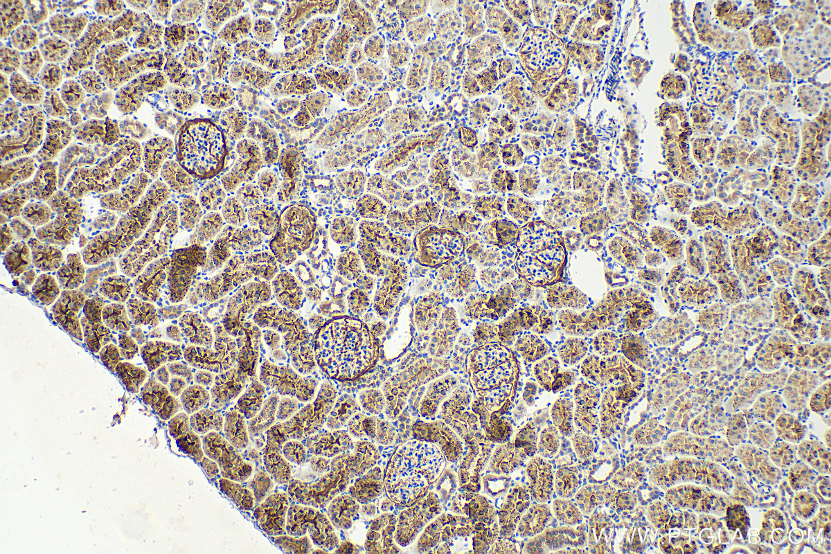 IHC staining of rat kidney using 15020-1-AP