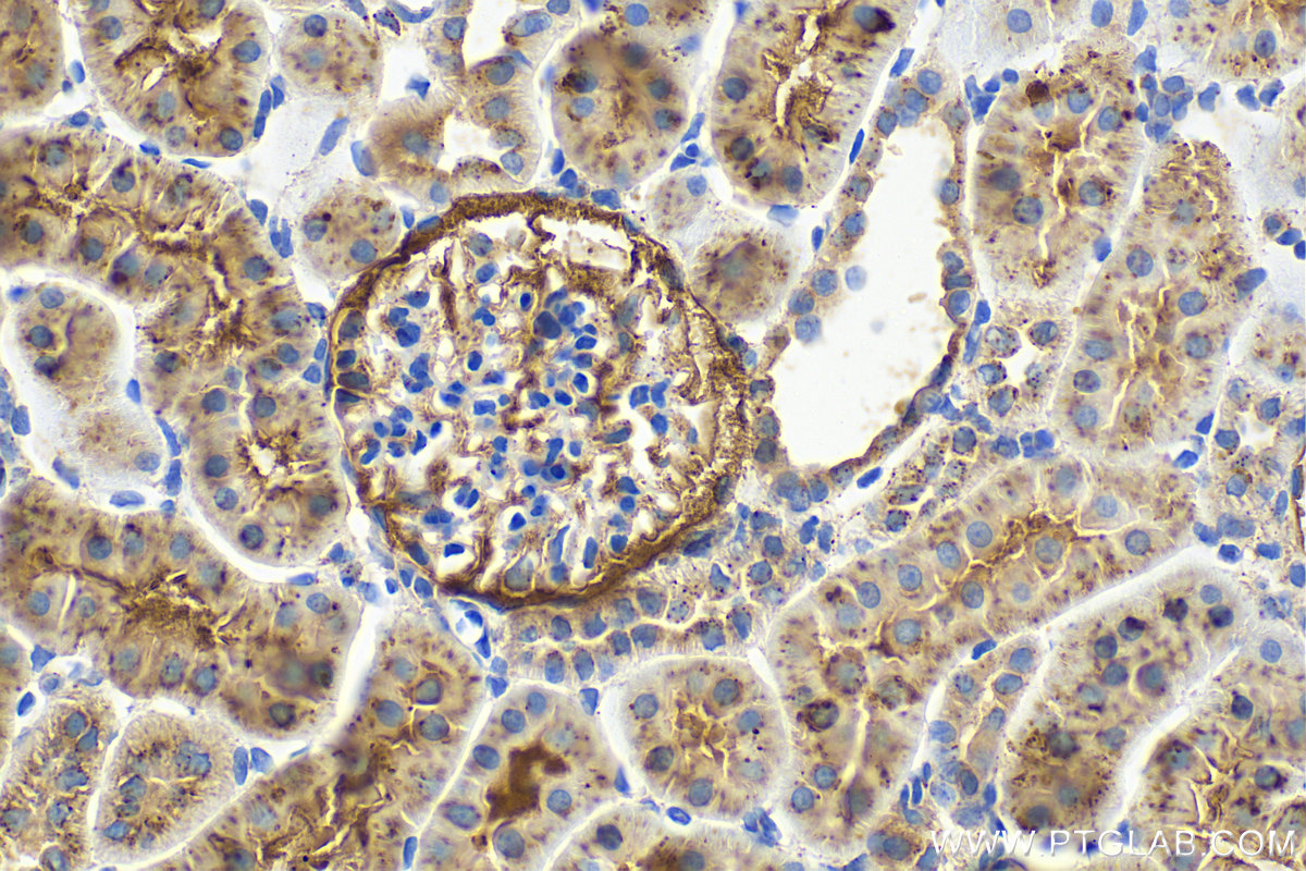IHC staining of rat kidney using 15020-1-AP