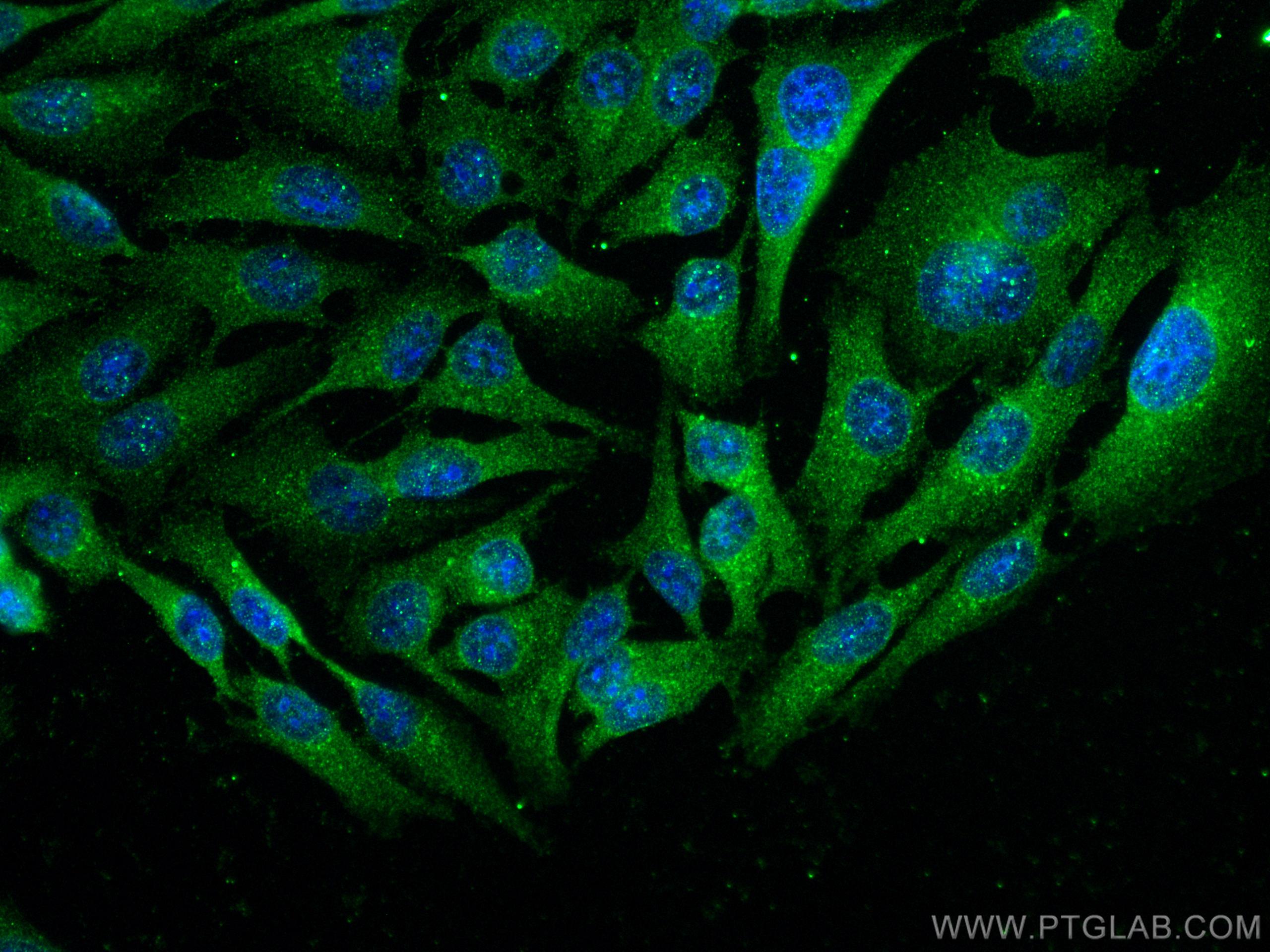 IF Staining of A375 using 12216-1-AP