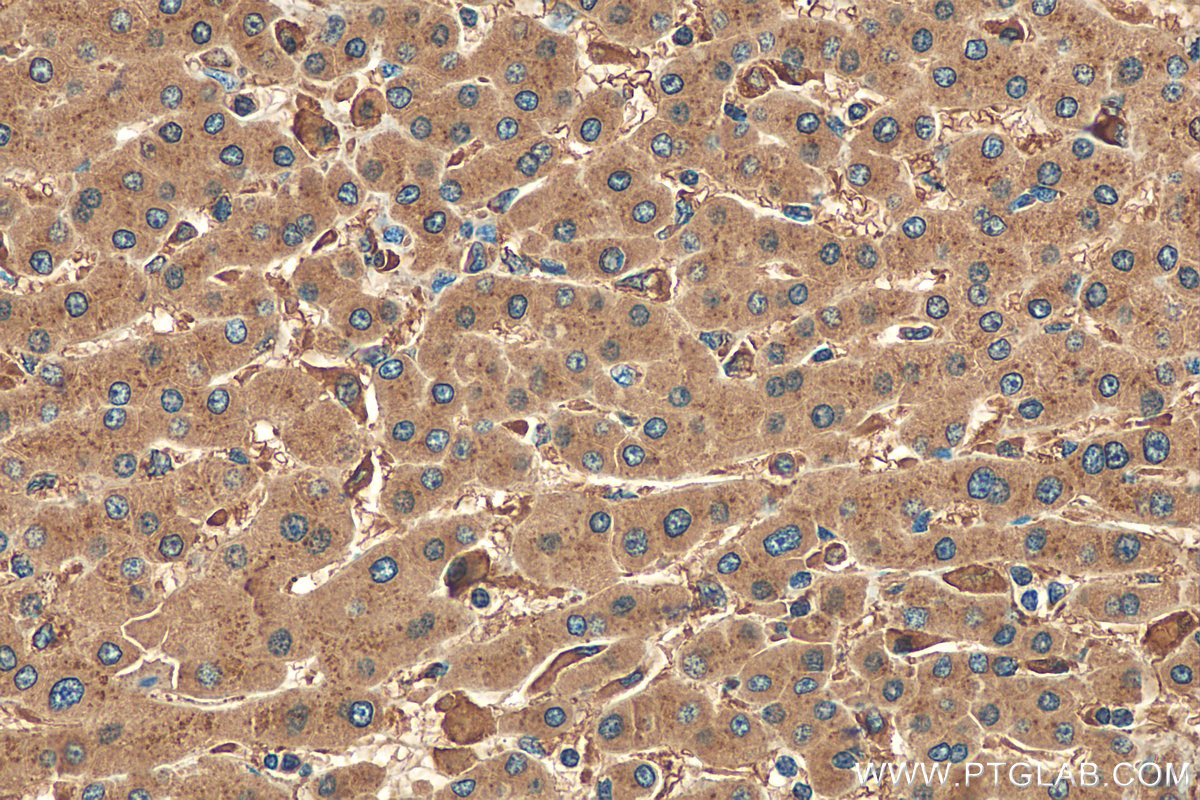 IHC staining of human hepatocirrhosis using 21327-1-AP (same clone as 21327-1-PBS)