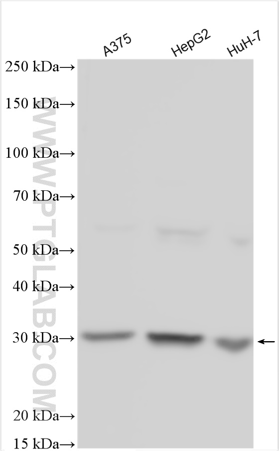 Cathepsin D Antibody 21327 1 AP Proteintech cathepsin-d-antibody-21327-1-ap-proteintech