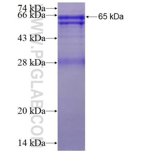 Cathepsin D fusion protein Ag15109 SDS-PAGE Cathepsin D fusion protein Ag15109 SDS-PAGE