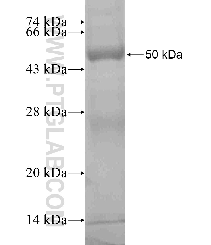 CTSE fusion protein Ag18484 SDS-PAGE CTSE fusion protein Ag18484 SDS-PAGE