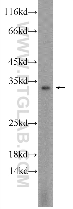 WB analysis of MCF-7 using 23840-1-AP