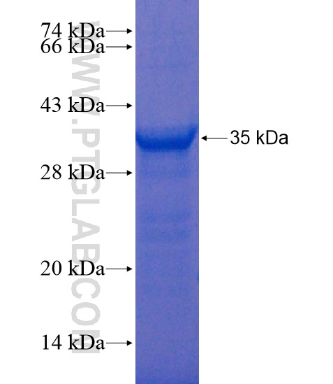 CTSG fusion protein Ag20818 SDS-PAGE