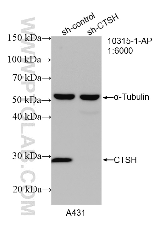 WB analysis of A431 using 10315-1-AP WB analysis of A431 using 10315-1-AP