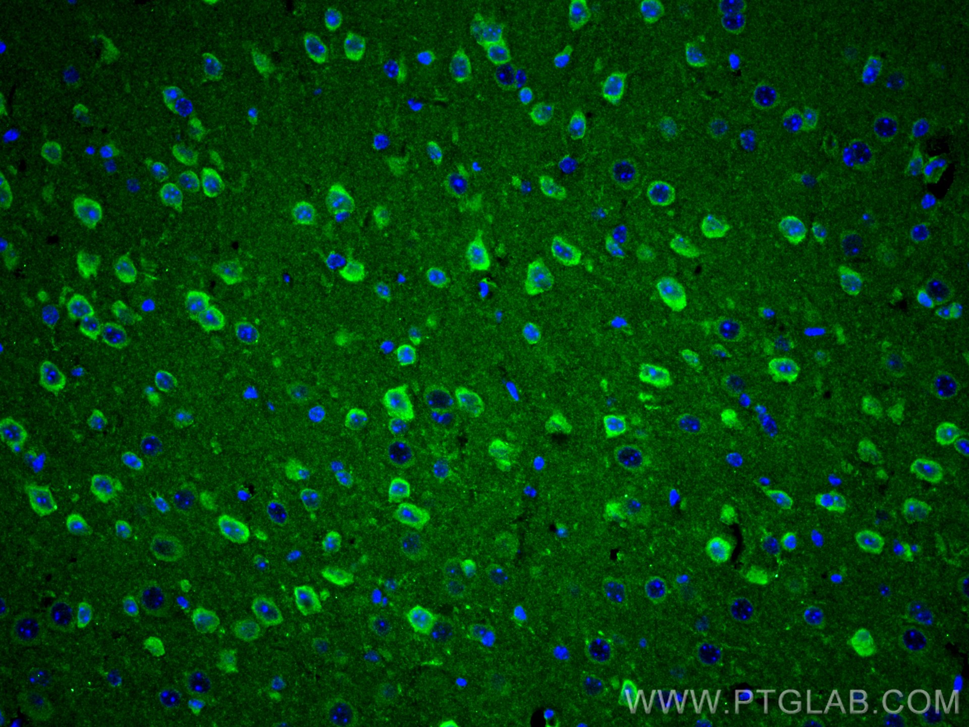 IF Staining of mouse brain using 11239-1-AP
