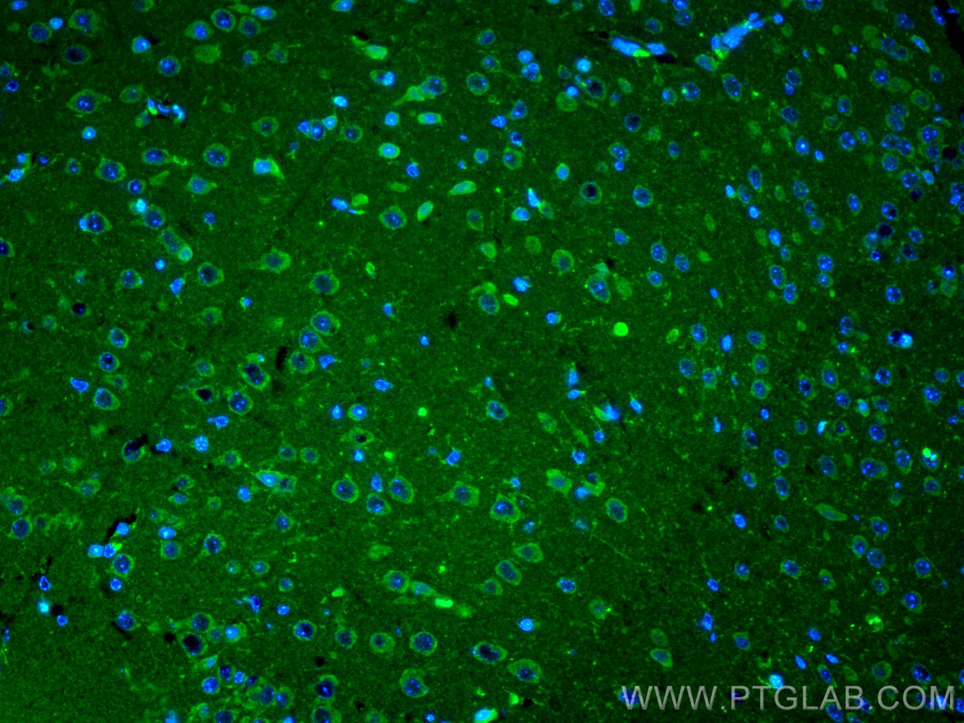 IF Staining of mouse brain using 11239-1-AP