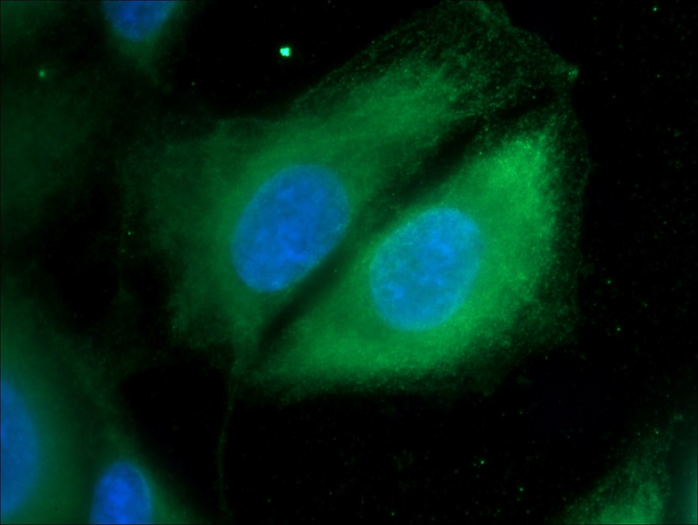 Cathepsin K