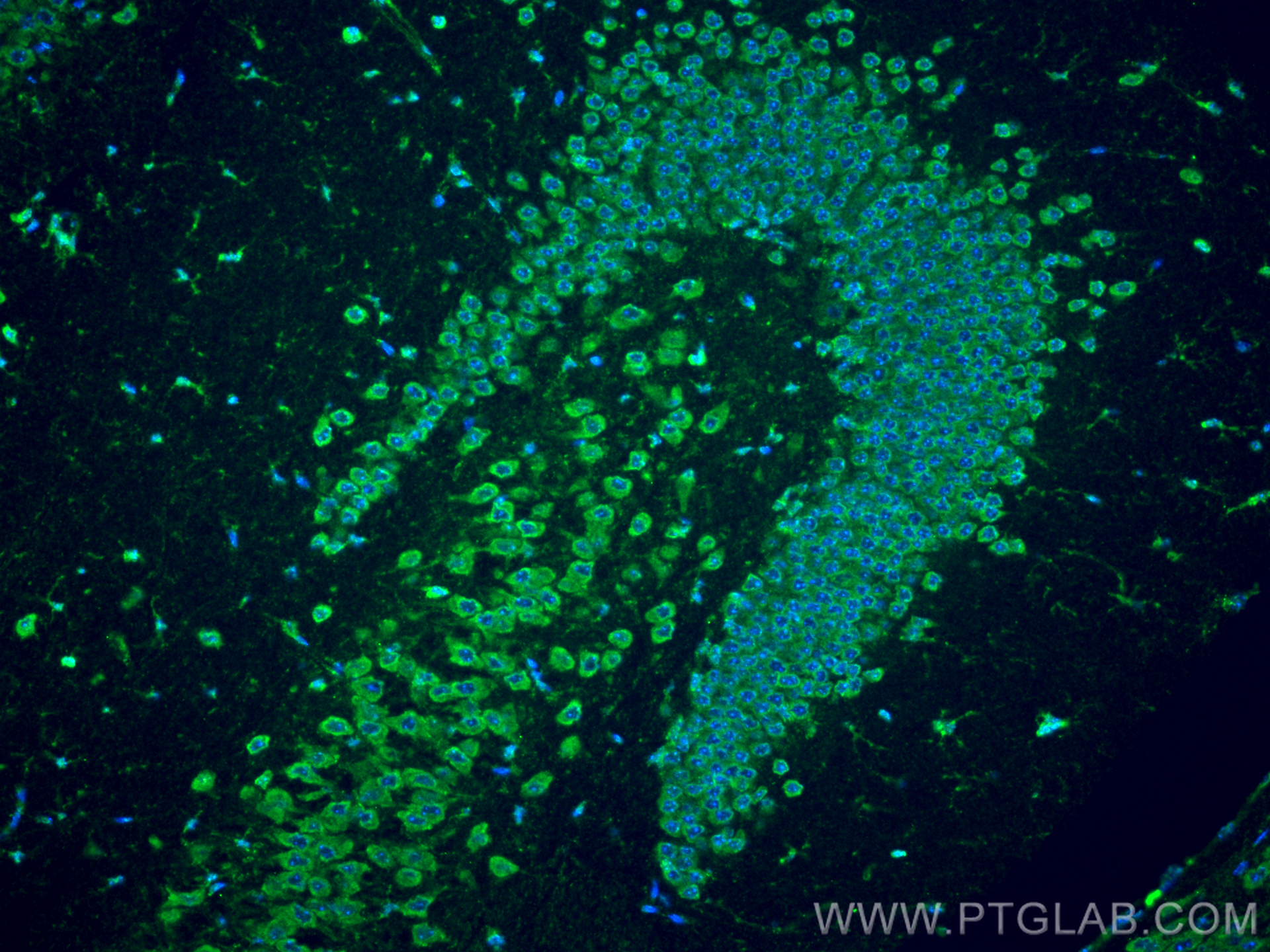 IF Staining of mouse brain using 11239-1-AP