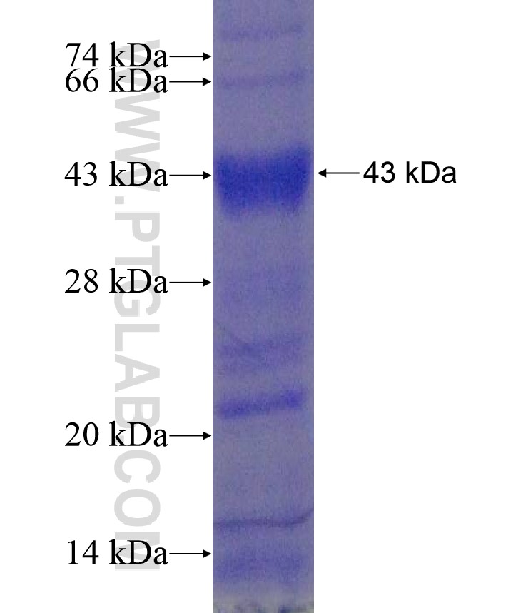 CTSK fusion protein Ag17904 SDS-PAGE CTSK fusion protein Ag17904 SDS-PAGE