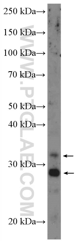 WB analysis of A549 using 10938-1-AP